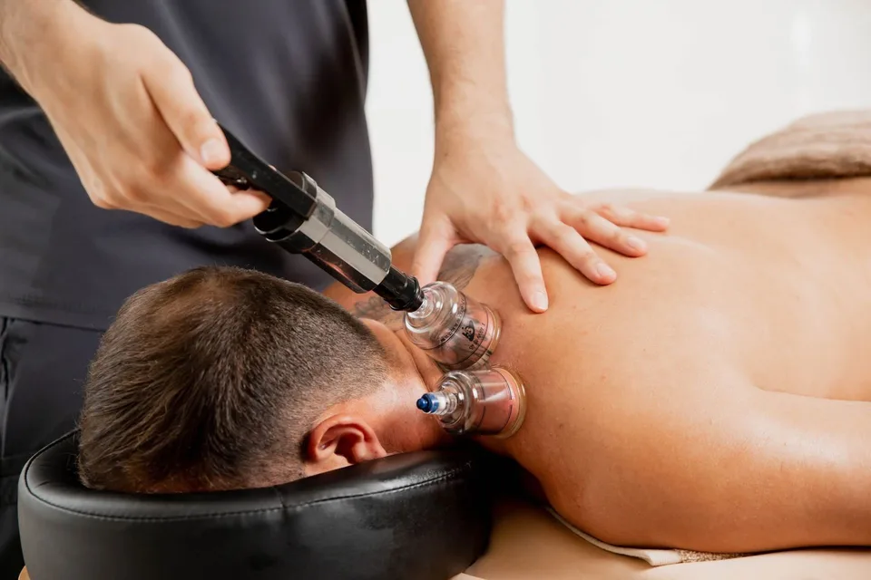 Terapia con Cupping en Ampax